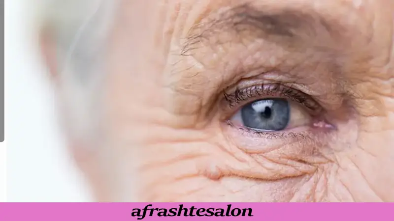 چگونه از چین و چروک صورت پیشگیری کنیم؟