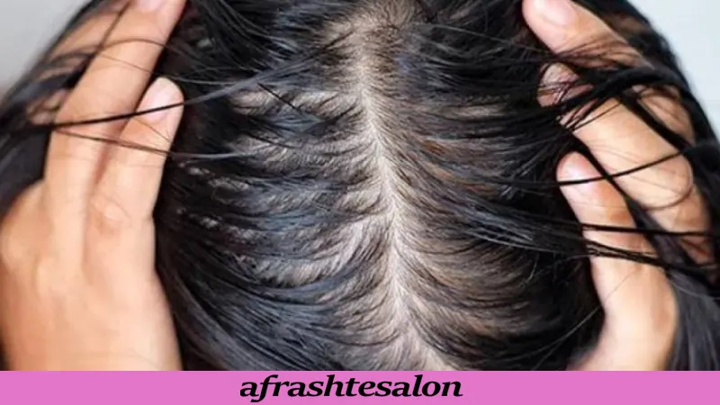 چگونه موهای چرب را کنترل کنیم؟